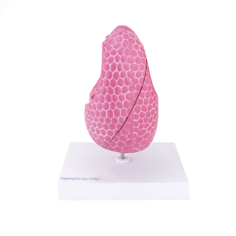 HeineScientific Lung Model with Diseases