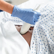 VITACON Vitascan cVue Bladder Scanner Portable Ultrasound