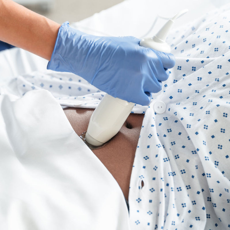 VITACON Vitascan cVue Bladder Scanner Portable Ultrasound