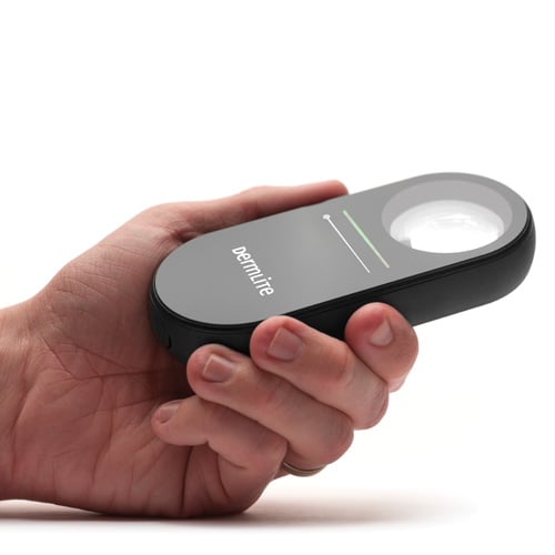 DermLite Lumio S Magnifying Exam Light