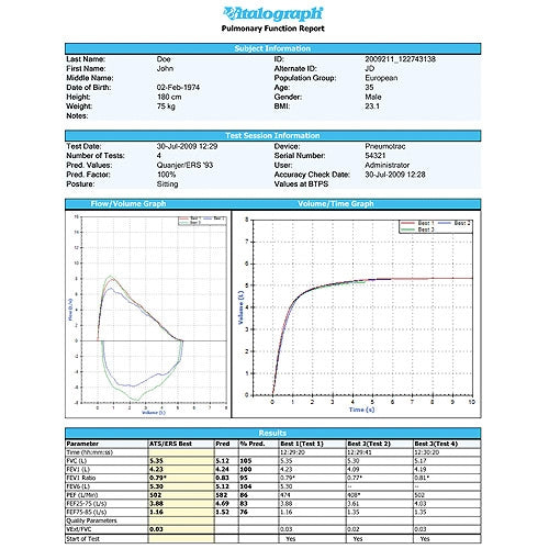 Vitalograph In2itive Spirometer with Software Options
