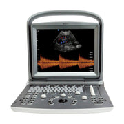 Chison ECO 6 Ultrasound Machine with Colour Doppler