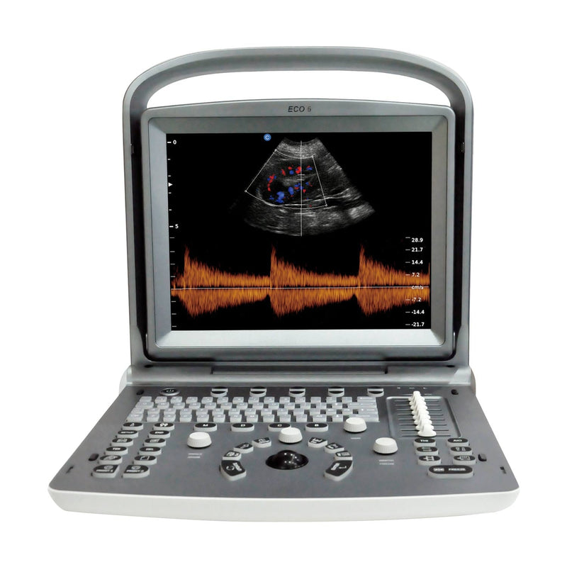 Chison ECO 6 Ultrasound Machine with Colour Doppler