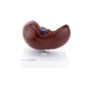 HeineScientific Liver and Gall Bladder Anatomical Model