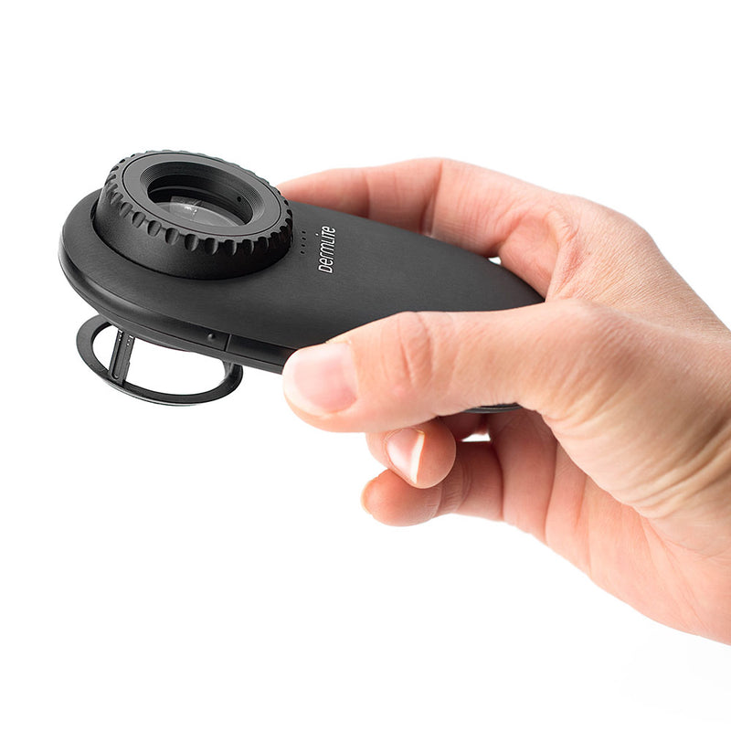 DermLite DL200 HR Dermatoscope with Polarised LEDs
