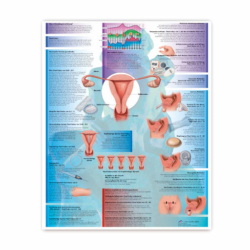 3B Scientific Contraception Wall Chart 50x67 cm