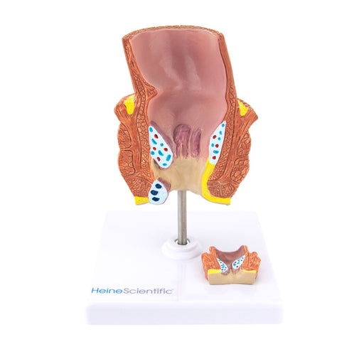 HeineScientific Haemorrhoid Anatomical Model