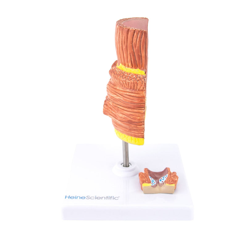 HeineScientific Haemorrhoid Anatomical Model
