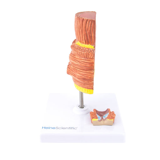 HeineScientific Haemorrhoid Anatomical Model