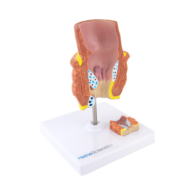 HeineScientific Haemorrhoid Anatomical Model