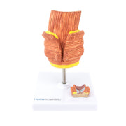 HeineScientific Haemorrhoid Anatomical Model