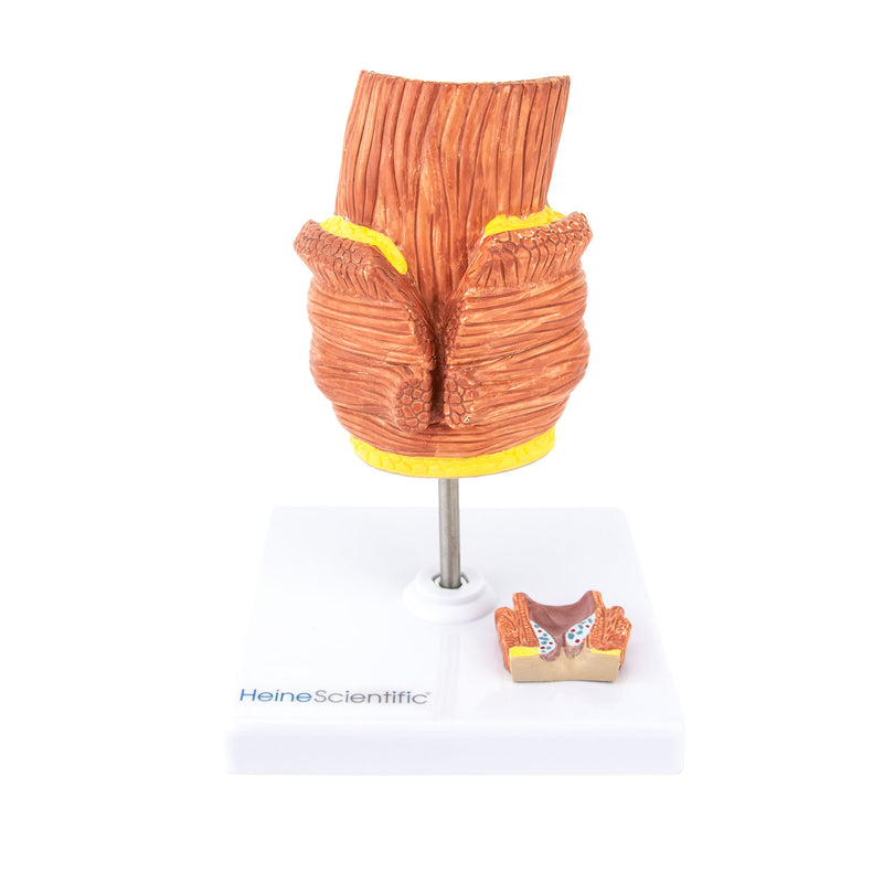 HeineScientific Haemorrhoid Anatomical Model