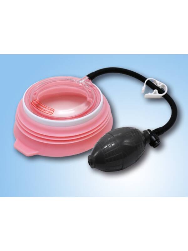 Vacuum Cup for Pectus Excavatum Treatment
