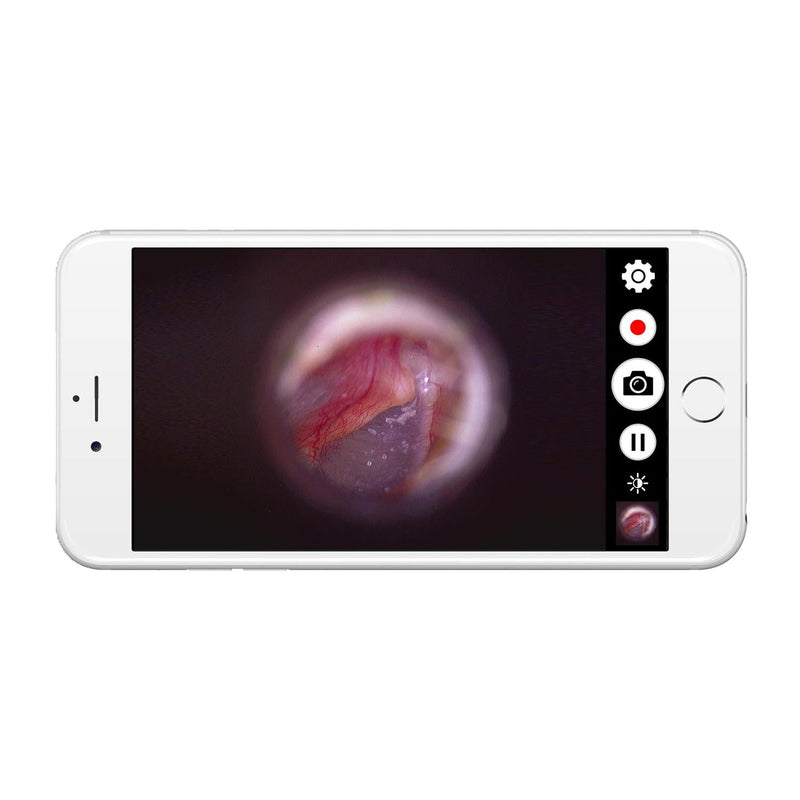 Firefly DE1270 HD Mobile Wireless Endoscope Camera