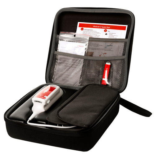 VITACON VitaScan v.2 Bladder Scanner