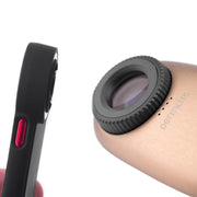 DermLite DL200 Hybrid Dermatoscope