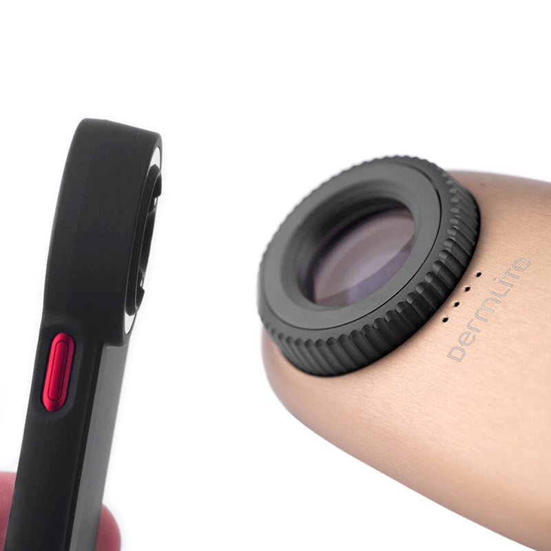 DermLite DL200 Hybrid Dermatoscope