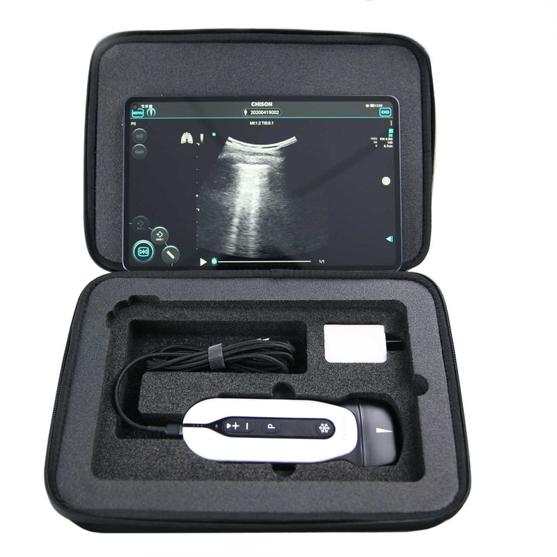 Chison SonoEye Transport Case Black