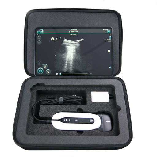 Chison SonoEye Transport Case Black