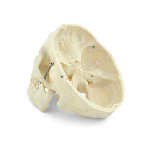 HeineScientific XC-104A Human Skull Model Life-Size