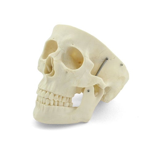 HeineScientific XC-104A Human Skull Model Life-Size