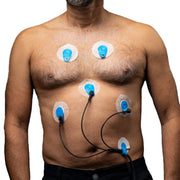 Ambu BlueSensor Ergometry Electrode