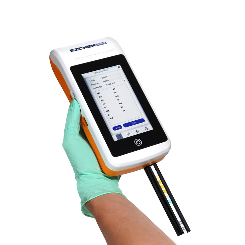 AllTest EZCHEK PLUS Urine Analyzer