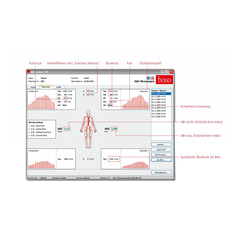 Bosch + Sohn boso ABI System 100 Specialized Diagnostics System