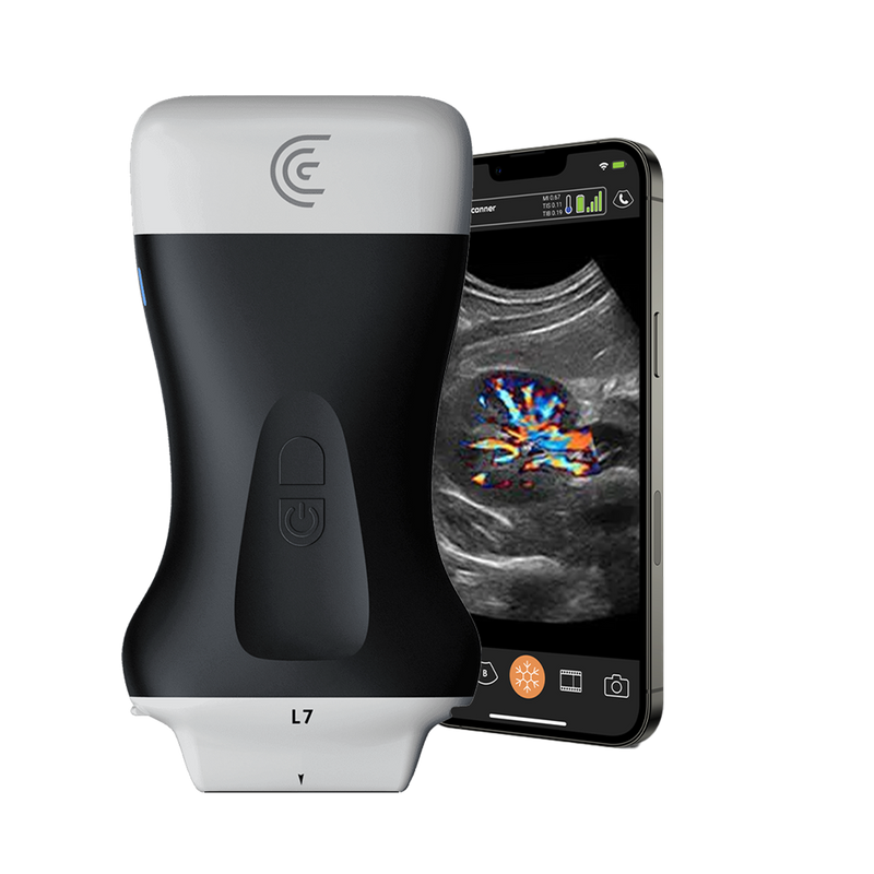 Clarius HD3 Ultrasound System