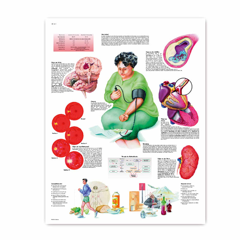 3B Scientific Blood Pressure Educational Wall Chart 50x67cm