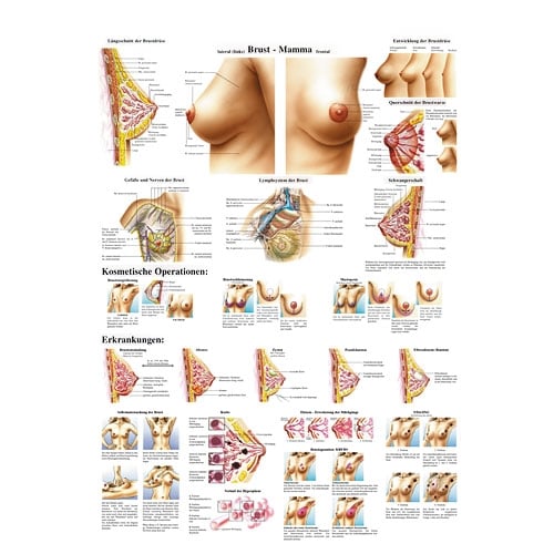 Erler-Zimmer Female Breast Wall Chart