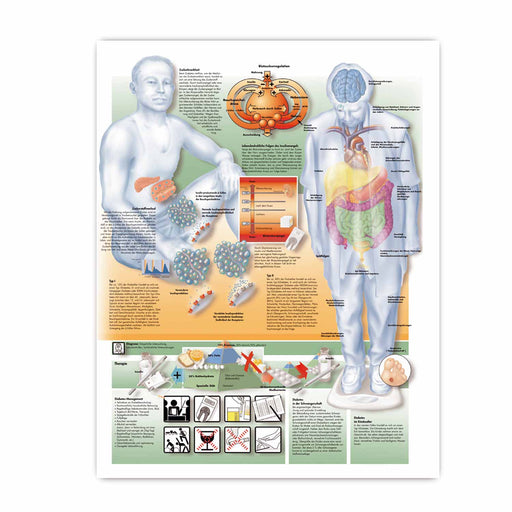 3B Scientific Diabetes Wall Chart Untearable Paper