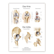Erler-Zimmer Knee and Hip Wall Chart with Hanging Cord