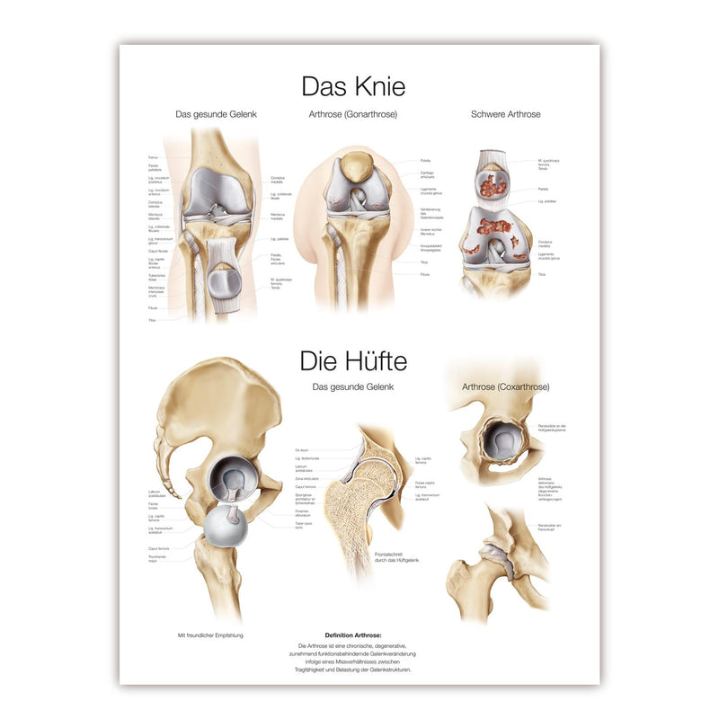 Erler-Zimmer Knee and Hip Wall Chart with Hanging Cord