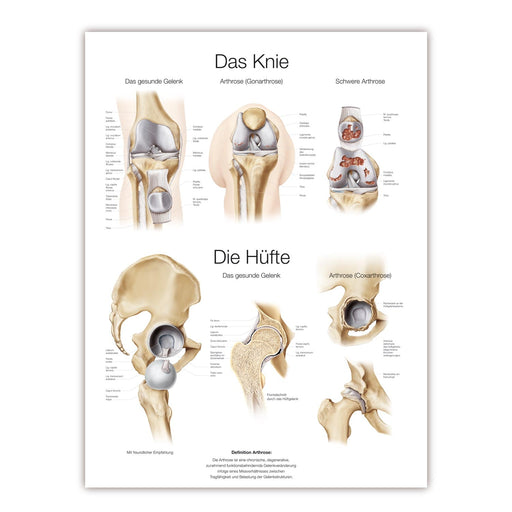 Erler-Zimmer Knee and Hip Wall Chart with Hanging Cord