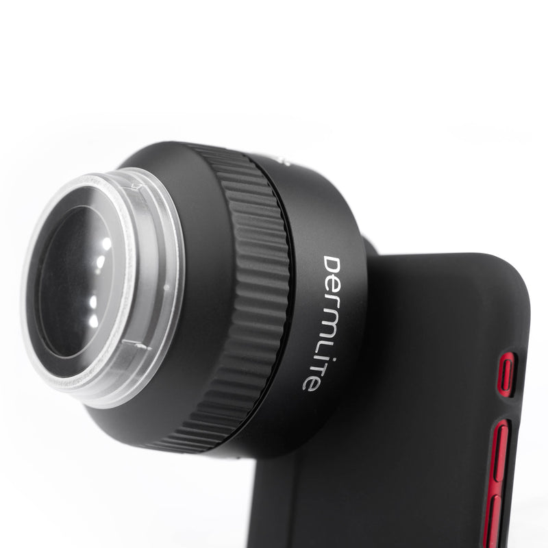 DermLite Foto X Compact Dermatoscopy Lens