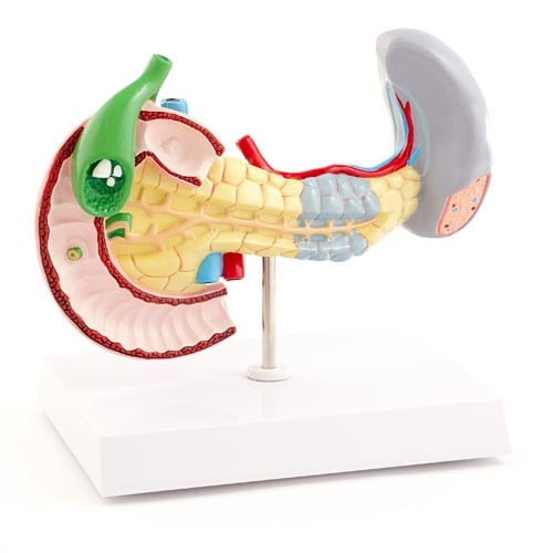 HeineScientific Diseased Pancreas, Spleen & Gallbladder Model