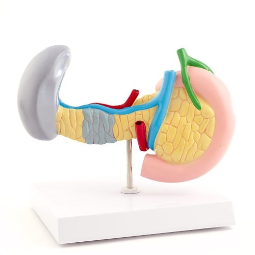HeineScientific Diseased Pancreas, Spleen & Gallbladder Model